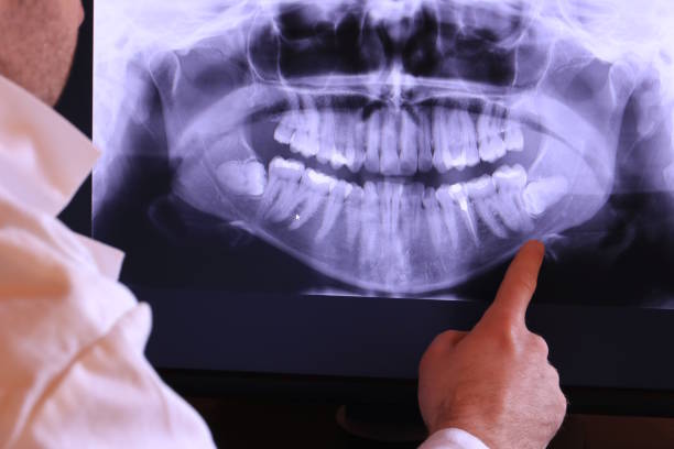 Best Tooth Infection Emergency Dentist  in Dubach, LA