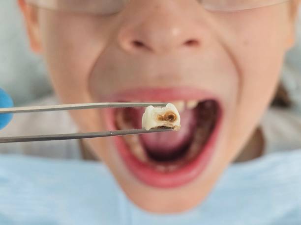 Best Urgent Dental Care  in Dubach, LA